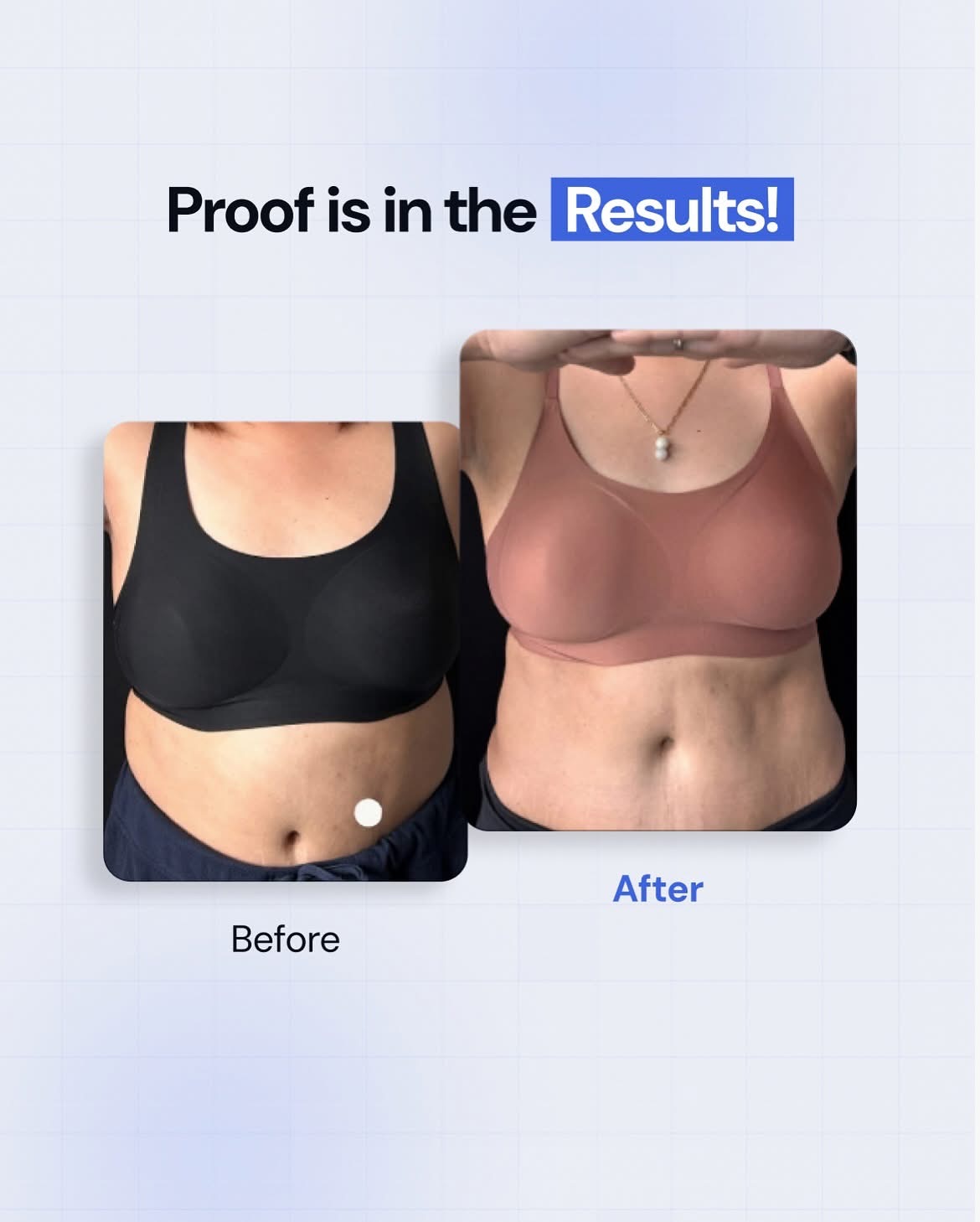 Thighs Hips Sculpting